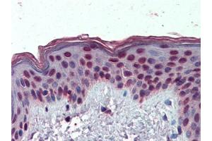 IHC Image of AP23070PU-N Human Skin: Formalin-Fixed, Paraffin-Embedded (FFPE) (HMGA1 抗体  (Internal Region))