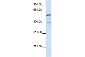 UGT1A6 antibody used at 1 ug/ml to detect target protein. (UGT1A6 抗体  (C-Term))