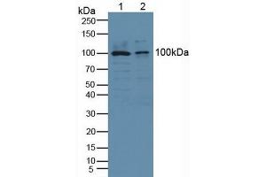 Detection of Recombinant cPLA2, Human using Polyclonal Antibody to Cytosolic Phospholipase A2 (PLA2G4) (PLA2G4A 抗体  (AA 563-749))