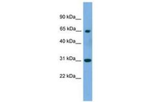 Image no. 1 for anti-Polynucleotide Kinase 3'-Phosphatase (PNKP) (AA 359-408) antibody (ABIN6744968) (PNKP 抗体  (AA 359-408))