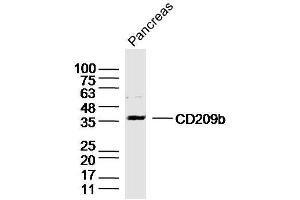 Pancreas lysates probed with DC-SIGNR1/CD209b Polyclonal Antibody, Unconjugated  at 1:300 dilution and 4˚C overnight incubation. (CD209b Antigen (CD209B) (AA 51-150) 抗体)