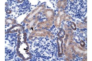 RGS13 antibody was used for immunohistochemistry at a concentration of 4-8 ug/ml to stain Epithelial cells of renal tubule (arrows) in Human Kidney. (RGS13 抗体  (Middle Region))