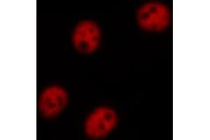 ABIN6267656 staining HeLa cells treated with TNF-a 20nM 15' by ICC/IF.