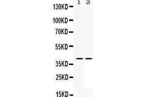 Western Blotting (WB) image for anti-Mitogen-Activated Protein Kinase Kinase 3 (MAP2K3) (AA 311-347), (C-Term) antibody (ABIN3043874)