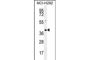 KCTD2 Antibody (C-term) (ABIN655466 and ABIN2844993) western blot analysis in NCI- cell line lysates (35 μg/lane). (KCTD2 抗体  (C-Term))