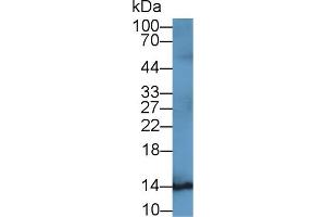 Detection of S100B in Rat Cerebrum lysate using Monoclonal Antibody to S100 Calcium Binding Protein B (S100B) (S100B 抗体  (AA 1-92))