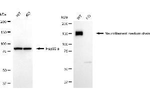 Western blotting analysis using neurofilament medium chain antibody (ABIN7800956). (Recombinant Neurofilament Medium Chain 抗体)