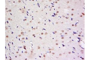 Formalin-fixed and paraffin embedded rat brain labeled with Anti-Dymeclin Polyclonal Antibody, Unconjugated  at 1:200 followed by conjugation to the secondary antibody and DAB staining.