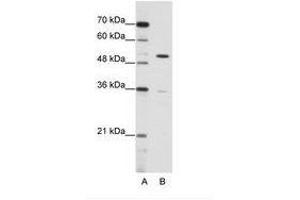 Image no. 1 for anti-Zinc Finger Protein 485 (ZNF485) (C-Term) antibody (ABIN6736173) (ZNF485 抗体  (C-Term))