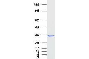Western Blotting (WB) image for Aldo-Keto Reductase Family 1, Member D1 (AKR1D1) protein (Myc-DYKDDDDK Tag) (ABIN2714509)