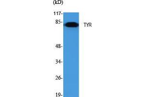 Western Blot (WB) analysis of specific cells using TYR Polyclonal Antibody.
