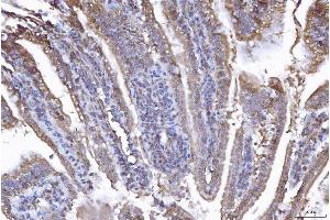 IHC analysis of EIF5A using anti-EIF5A antibody (ABIN7602568). (EIF5A 抗体  (AA 86-154))