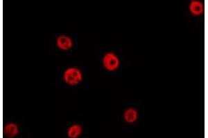 ABIN6267642 staining Hela by IF/ICC. (HDAC1 抗体  (pSer421))
