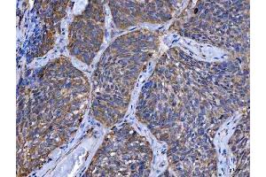 IHC analysis of TMPRSS13 using anti-TMPRSS13 antibody (ABIN7599797).