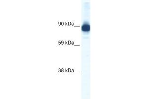 WB Suggested Anti-ACTN2 Antibody Titration:  0. (ACTN2 抗体  (C-Term))