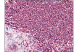 Formalin-Fixed, Paraffin-Embedded Human Spleen stained with Thrombospondin-1 antibody at 3. (Thrombospondin 1 抗体  (N-Term))
