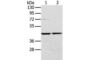 Western Blot analysis of Hepg2 and hela cell using RRAGA Polyclonal Antibody at dilution of 1:400 (RRAGA 抗体)