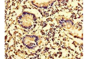 Immunohistochemistry of paraffin-embedded human appendix tissue using ABIN7157942 at dilution of 1:100 (Latexin 抗体  (AA 1-216))
