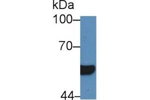 Western blot analysis of Human Serum, using Human HNF1b Antibody (5 µg/ml) and HRP-conjugated Goat Anti-Rabbit antibody ( (HNF1B 抗体  (AA 159-300))