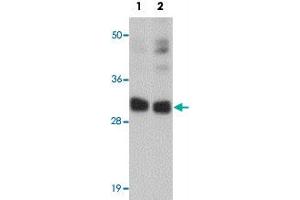Western blot analysis of CCDC106 in human brain tissue lysate with CCDC106 polyclonal antibody  at (1) 0. (CCDC106 抗体  (C-Term))