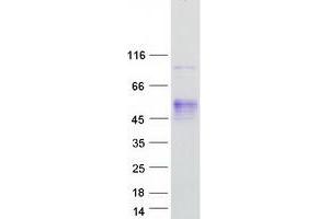 Western Blotting (WB) image for ATPase, Na+/K+ Transporting, beta 2 Polypeptide (ATP1B2) protein (Myc-DYKDDDDK Tag) (ABIN2715040)