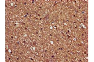 IHC image of ABIN7169246 diluted at 1:600 and staining in paraffin-embedded human brain tissue performed on a Leica BondTM system.