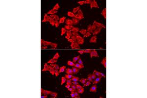 Immunofluorescence analysis of HeLa cell using SMPX antibody. (SMPX 抗体)