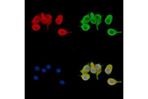 ABIN7095482 and ABIN7099539 staining Hela cells by IF/ICC.