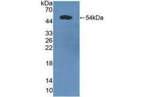 Western blot analysis of recombinant Human PDCD6IP.