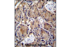LIMD1 Antibody (C-term) (ABIN657056 and ABIN2846223) immunohistochemistry analysis in formalin fixed and paraffin embedded human stomach tissue followed by peroxidase conjugation of the secondary antibody and DAB staining. (LIMD1 抗体  (C-Term))