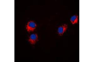 Immunofluorescent analysis of Paxillin staining in Hela cells. (Paxillin 抗体  (N-Term))