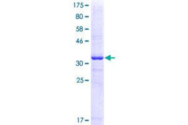 Metabotropic Glutamate Receptor 1 Protein (AA 387-486) (GST tag)