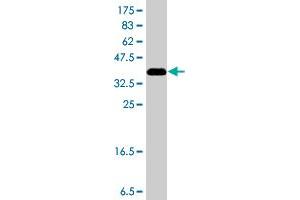 Western Blot detection against Immunogen (37 KDa) . (TNK2 抗体  (AA 21-120))