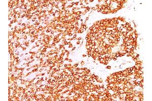 Formalin-fixed, paraffin-embedded human Tonsil stained with CD45RB Monoclonal Antibody (DF-B1). (CD45 抗体)