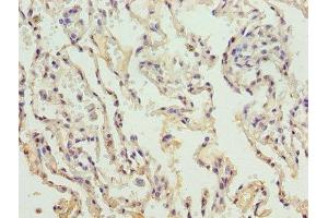 Immunohistochemistry of paraffin-embedded human lung tissue using ABIN7148251 at dilution of 1:100 (COL4a3 抗体  (AA 1427-1668))