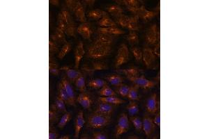 Immunofluorescence (IF) image for anti-Interferon-Induced Transmembrane Protein 3 (IFITM3) (AA 1-133) antibody (ABIN6142186)