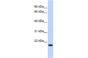 WB Suggested Anti-IRF7 Antibody Titration:  0. (IRF7 抗体  (N-Term))