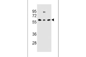 Western blot analysis in NCI-H460,293,MDA-MB231 cell line lysates (35ug/lane). (CLEC17A 抗体  (C-Term))