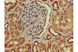 Immunohistochemistry of paraffin-embedded human kidney tissue using ABIN7156860 at dilution of 1:100 (IL22RA2 抗体  (AA 22-263))