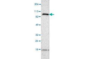 Western blot analysis of human cell line RT-4 with FANCB polyclonal antibody . (FANCB 抗体)