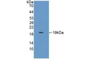 Detection of Recombinant CA12, Rat using Polyclonal Antibody to Carbonic Anhydrase XII (CA12) (CA12 抗体  (AA 154-307))