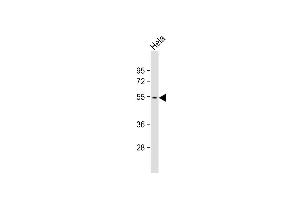 Anti-PKK5 Antibody  at 1:1000 dilution + Hela whole cell lysate Lysates/proteins at 20 μg per lane. (MAPKAP Kinase 5 抗体  (AA 160-189))