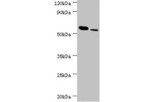 Western blot All lanes: RNF8 antibody at 11 μg/mL Lane 1: Hela whole cell lysate Lane 2: 293T whole cell lysate Secondary Goat polyclonal to rabbit IgG at 1/10000 dilution Predicted band size: 56, 11, 51 kDa Observed band size: 56 kDa (RNF8 抗体  (AA 1-260))