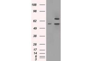 Image no. 2 for anti-Protein Phosphatase 5, Catalytic Subunit (PPP5C) antibody (ABIN1500391) (PP5 抗体)