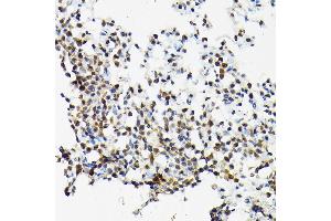 Immunohistochemistry (IHC) image for anti-serine/arginine-Rich Splicing Factor 2 (SRSF2) (AA 1-75) antibody (ABIN1682677)