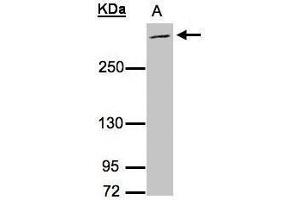 WB Image Sample (30μg whole cell lysate) A:Raji , 5% SDS PAGE antibody diluted at 1:3000 (MUC2 抗体  (C-Term))