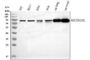 Western blot analysis of FOXO3A using anti-FOXO3A antibody (ABIN3042404). (FOXO3 抗体  (AA 471-673))