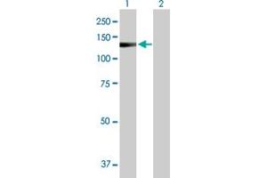 anti-Immunoglobulin-Like and Fibronectin Type III Domain Containing 1 (IGFN1) (AA 1-868) antibody