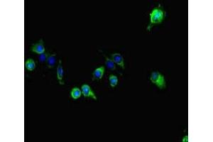 Immunofluorescent analysis of Hela cells using ABIN7163856 at dilution of 1:100 and Alexa Fluor 488-congugated AffiniPure Goat Anti-Rabbit IgG(H+L) (GALNT11 抗体  (AA 420-606))