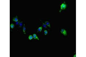 Immunofluorescent analysis of Hela cells using ABIN7163856 at dilution of 1:100 and Alexa Fluor 488-congugated AffiniPure Goat Anti-Rabbit IgG(H+L) (GALNT11 抗体  (AA 420-606))